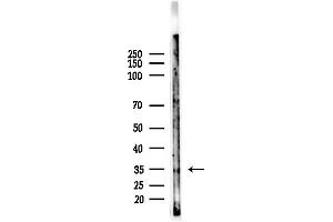Western blot analysis of lysates from EC304 cells, using TAS2R10 Antibody at 1/1000 dilution.
