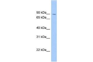 WB Suggested Anti-SATB1 Antibody Titration: 0. (SATB1 anticorps  (Middle Region))