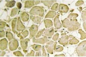 Immunohistochemistry (IHC) analyzes of Cytochrome b5 antibody in paraffin-embedded human heart tissue. (CYB5R3 anticorps)