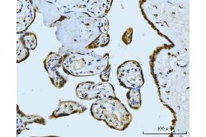 IHC analysis of MRE11 using anti-MRE11 antibody (ABIN7600025). (Mre11 anticorps  (AA 14-481))