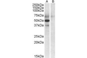 Image no. 1 for anti-Apolipoprotein L, 4 (APOL4) (C-Term) antibody (ABIN375002) (Apolipoprotein L 4 anticorps  (C-Term))