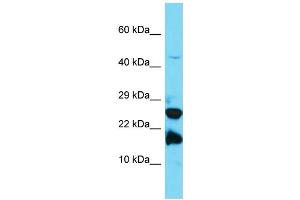 Host: Rabbit Target Name: A2LD1 Sample Type: Jurkat Whole Cell lysates Antibody Dilution: 1. (GGACT anticorps  (N-Term))