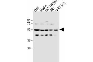 All lanes : Anti-PFKFB4 Antibody (Center) at 1:1000 dilution Lane 1: Raji, whole cell lysate Lane 2: Molt-4 whole cell lysate Lane 3: NCI- whole cell lysate Lane 4: 293 whole cell lysate Lane 5: U-87 MG whole cell lysate Lysates/proteins at 20 μg per lane. (PFKFB4 anticorps  (AA 266-296))
