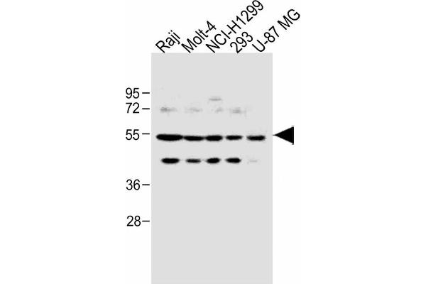 PFKFB4 anticorps  (AA 266-296)