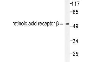 Image no. 1 for anti-Retinoic Acid Receptor, beta (RARB) antibody (ABIN271806) (Retinoic Acid Receptor beta anticorps)