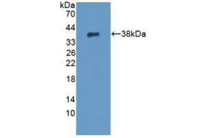 Detection of Recombinant PADI6, Human using Polyclonal Antibody to Peptidyl Arginine Deiminase Type VI (PADI6) (PADI6 anticorps  (AA 393-694))