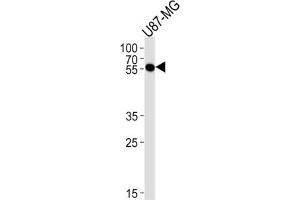 Western Blotting (WB) image for anti-Cytidine Monophosphate N-Acetylneuraminic Acid Synthetase (CMAS) antibody (ABIN3004736) (CMAS anticorps)