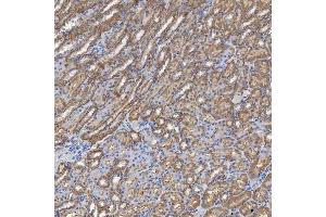 IHC analysis of SHQ1 using anti-SHQ1 antibody (ABIN7599205). (SHQ1 anticorps  (AA 1-277))