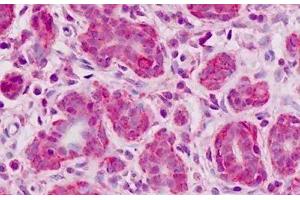Human Breast, Epithelium: Formalin-Fixed, Paraffin-Embedded (FFPE)