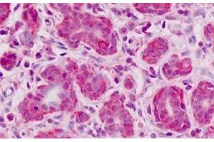 Human Breast, Epithelium: Formalin-Fixed, Paraffin-Embedded (FFPE) (FAM62B anticorps  (AA 564-921))