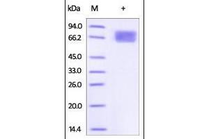SDS-PAGE (SDS) image for Interleukin 2 Receptor, alpha (IL2RA) (AA 22-213) (Active) protein (Fc Tag) (ABIN2181381) (CD25 Protein (AA 22-213) (Fc Tag))