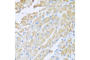 Immunohistochemistry of paraffin-embedded mouse heart using IL18BP antibody (ABIN5973845) at dilution of 1/100 (40x lens). (IL18BP anticorps)