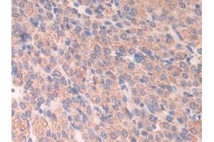 Detection of ATF7 in Mouse Ovary Tissue using Polyclonal Antibody to Activating Transcription Factor 7 (ATF7)