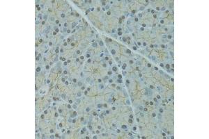 Immunohistochemistry of paraffin-embedded rat pancreas using SERPINF2 antibody  at dilution of 1:100 (40x lens).