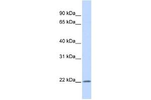 WB Suggested Anti-IFNA5 Antibody Titration: 0. (IFNA5 anticorps  (Middle Region))