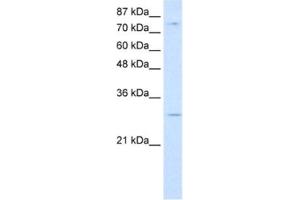 Western Blotting (WB) image for anti-RNA Binding Motif Protein 28 (RBM28) antibody (ABIN2462278)