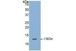 Detection of Recombinant tPA, Human using Polyclonal Antibody to Tissue Plasminogen Activator (tPA) (PLAT anticorps)