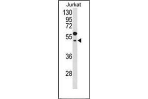 Western blot analysis of GNAT1 Antibody (C-term) in Jurkat cell line lysates (35ug/lane).
