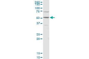 CDC14B polyclonal antibody (A01), Lot # 06046. (CDC14B anticorps  (AA 360-459))