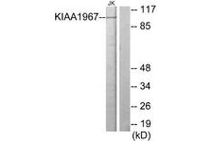 Western Blotting (WB) image for anti-Cell Cycle and Apoptosis Regulator 2 (CCAR2) (AA 431-480) antibody (ABIN2889671) (CCAR2 anticorps  (AA 431-480))