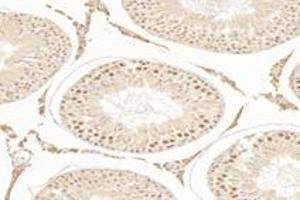 Immunohistochemistry analysis of paraffin-embedded rat testis using,TBXT (ABIN7075815) at dilution of 1: 3200