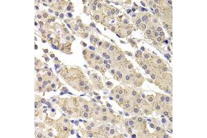 Immunohistochemistry of paraffin-embedded human stomach using DFFA antibody at dilution of 1:100 (x400 lens).