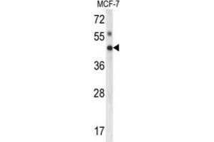 Western Blotting (WB) image for anti-Inositol Polyphosphate Multikinase (IPMK) antibody (ABIN3003997) (IPMK anticorps)