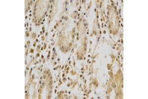 Immunohistochemistry of paraffin-embedded human stomach using HDAC6 antibody at dilution of 1:200 (x400 lens) (HDAC6 anticorps  (AA 1-200))