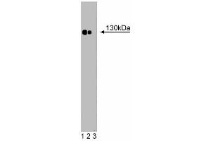Western blot analysis of Phospholipase Cbeta4 on a rat pituitary lysate (left).