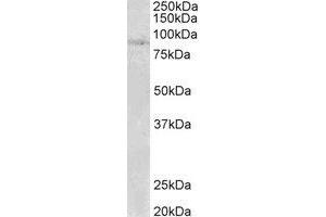 Western Blotting (WB) image for anti-SET Domain, Bifurcated 2 (SETDB2) (N-Term) antibody (ABIN2465045) (SETDB2 anticorps  (N-Term))