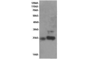 Western Blot analysis of Rat brain and Mouse brain tissue using LHB Polyclonal Antibody at dilution of 1:600 (LHB anticorps)