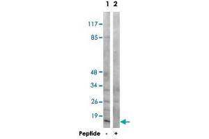 Western blot analysis of extracts from COS-7 cells, using MRPS21 polyclonal antibody . (MRPS21 anticorps)
