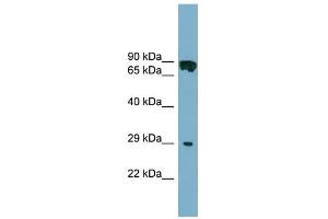 WB Suggested Anti-CYB5D1 Antibody Titration: 0. (CYB5D1 anticorps  (Middle Region))