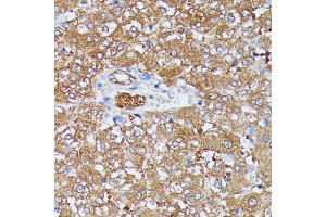 Immunohistochemistry of paraffin-embedded rat liver using HDLBP antibody (ABIN6128051, ABIN6141701, ABIN6141702 and ABIN6221672) at dilution of 1:100 (40x lens).
