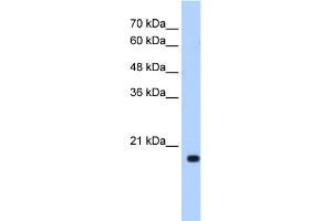 WB Suggested Anti-XTP3TPA Antibody Titration:  0. (DCTPP1 anticorps  (N-Term))
