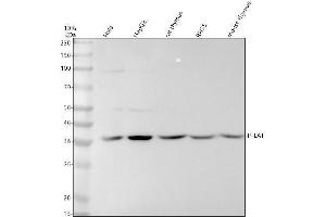 Western blot analysis of P-LAT using anti-P-LAT antibody (ABIN7603442).
