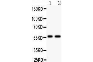 Anti- PIAS4 antibody, Western blotting All lanes: Anti PIAS4  at 0. (PIAS4 anticorps  (C-Term))
