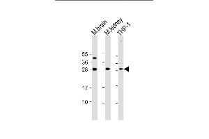All lanes : Anti-TPD52 Antibody (N-Term) at 1:2000 dilution Lane 1: mouse brain lysate Lane 2: mouse kidney lysate Lane 3: THP-1 whole cell lysate Lysates/proteins at 20 μg per lane. (TPD52 anticorps  (AA 11-44))
