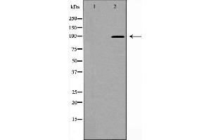 Western blot analysis of PSD95 expression in Brain (Rat) Tissue Lysate,The lane on the left is treated with the antigen-specific peptide. (DLG4 anticorps  (C-Term))