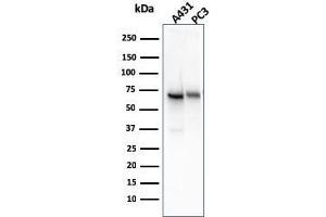 Western Blot Analysis of A431 and PC-3 cell lysate using CD73 Mouse Monoclonal Antibody (NT5E/2545). (CD73 anticorps)