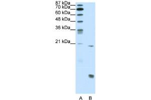 WB Suggested Anti-RUNX1 Antibody Titration:  0. (RUNX1 anticorps  (N-Term))