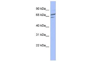 WB Suggested Anti-PGM1 Antibody Titration: 0. (Phosphoglucomutase 1 anticorps  (Middle Region))
