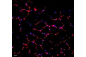 Immunofluorescence of paraffin embedded mouse Skeletal muscle using SMYD2 (ABIN7075581) at dilution of 1:1000 (400x lens)