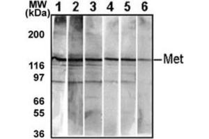 Western Blotting (WB) image for anti-Met Proto-Oncogene (MET) antibody (ABIN2995275) (c-MET anticorps)