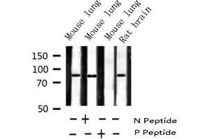 Western blot analysis of Phospho-IKK beta (Tyr199) expression in various lysates