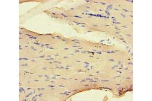 Immunohistochemistry of paraffin-embedded human skeletal muscle tissue using ABIN7161435 at dilution of 1:100 (NRP2 anticorps  (AA 60-209))