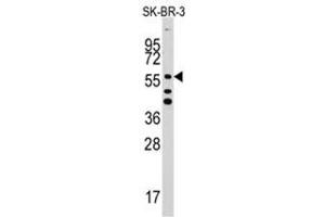 Image no. 1 for anti-Aldehyde Dehydrogenase 5 Family, Member A1 (ALDH5A1) (C-Term) antibody (ABIN356986)