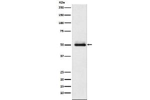 Western blot analysis of Cytochrome P450 2C9 expression in HepG2 cell lysate.