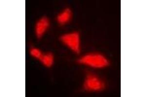 Immunofluorescent analysis of APOBEC3G staining in MCF7 cells.