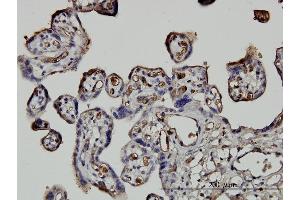Immunoperoxidase of monoclonal antibody to NEDD1 on formalin-fixed paraffin-embedded human placenta. (NEDD1 anticorps  (AA 561-660))